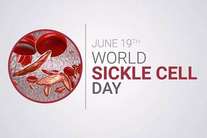 World Sickle Cell Day 2025