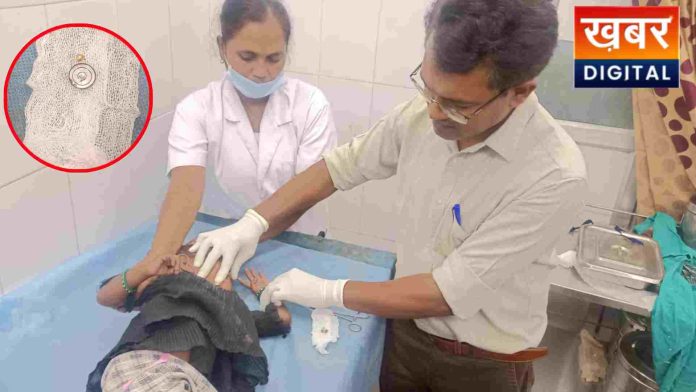 Saved The Childs Life By Removing The Coin Shaped Metal Piece Stuck In His Mouth 696x392