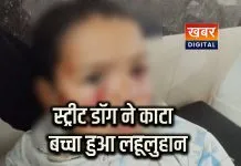 4 साल के बालक को स्ट्रीट डॉग ने काटा... बच्चा हुआ लहुलूहान बच्चे को कराया भर्ती